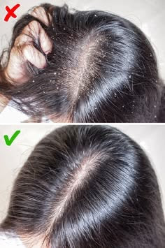 AVC Calm Scalp Mist Spray