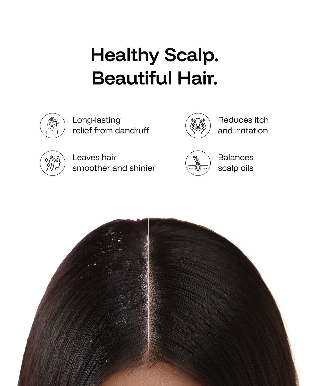 AVC Calm Scalp Mist Spray