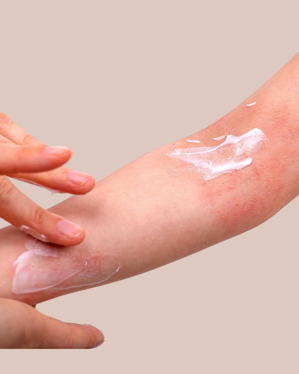 Multi-Purpose Rescue Balm | All-Natural Skin Repair
